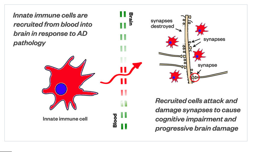 A graphic depiction of how aberrant innate immune cells in the blood pass through the blood brain barrier and disrupt and damage the synaptic process in the brain.