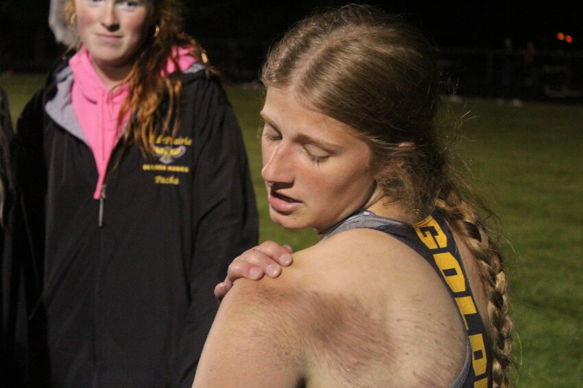 Jovi Evans of Mid-Prairie shows the scrapes on her back after winning the 200-meter run at an Iowa 2A state track qualifier in Eddyville.