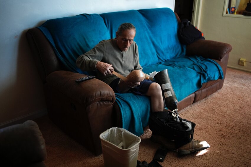 Blas Sanchez prepares to put on a prosthetic on Jan. 26 in Winslow, Ariz. Sanchez's leg was mutilated while working near the chicken manure chute as a prison laborer at Hickman's Family Farms in 2015 in Tonopah, Ariz.