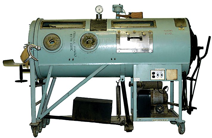 An Iron Lung was used to help polio patients breathe, in many cases keeping them alive.