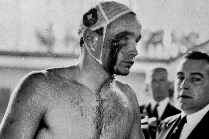 Ervin Zador of the Hungarian water polo team emerges from the pool with a bloodied face at the 1956 Olympics. He was punched by his Soviet counterpart, Valentin Prokopov, in what became the most violent sporting match in Olympic history.