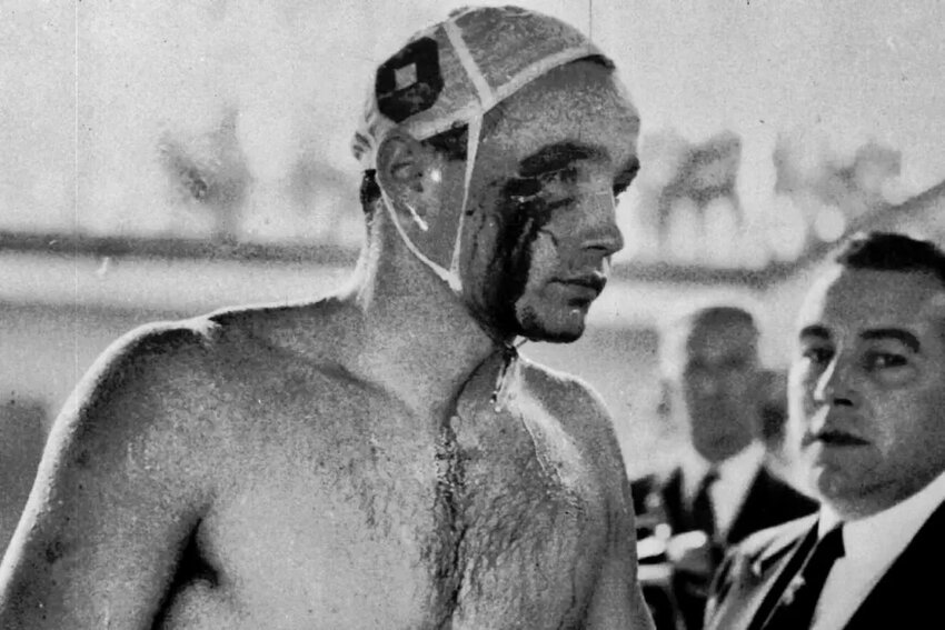 Ervin Zador of the Hungarian water polo team emerges from the pool with a bloodied face at the 1956 Olympics where he was punched by his Soviet counterpart, Valentin Prokopov.